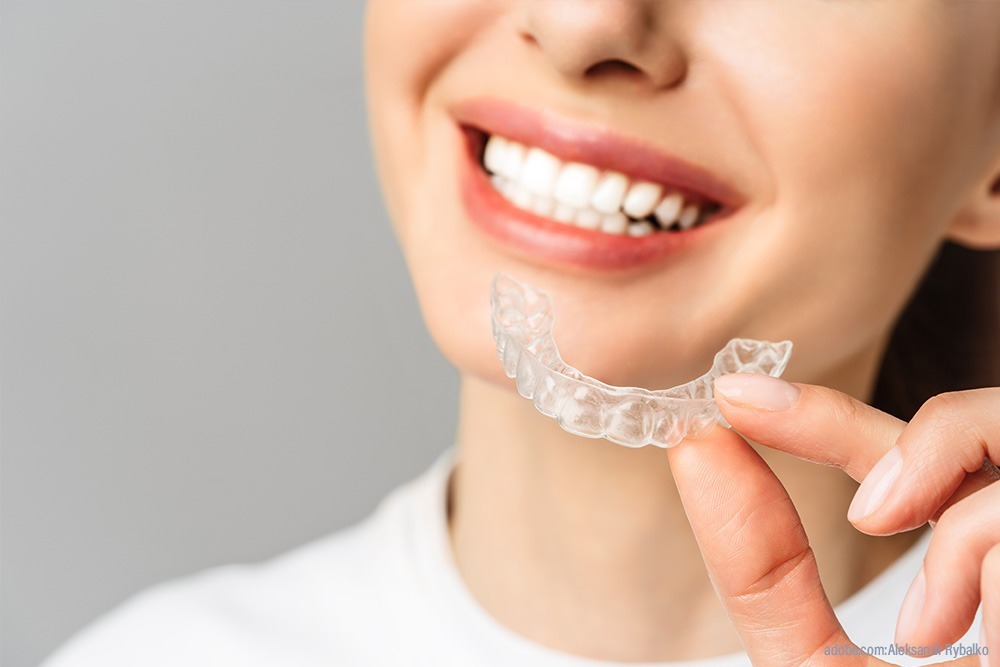 Aligner beim Zahnarzt Hildesheim